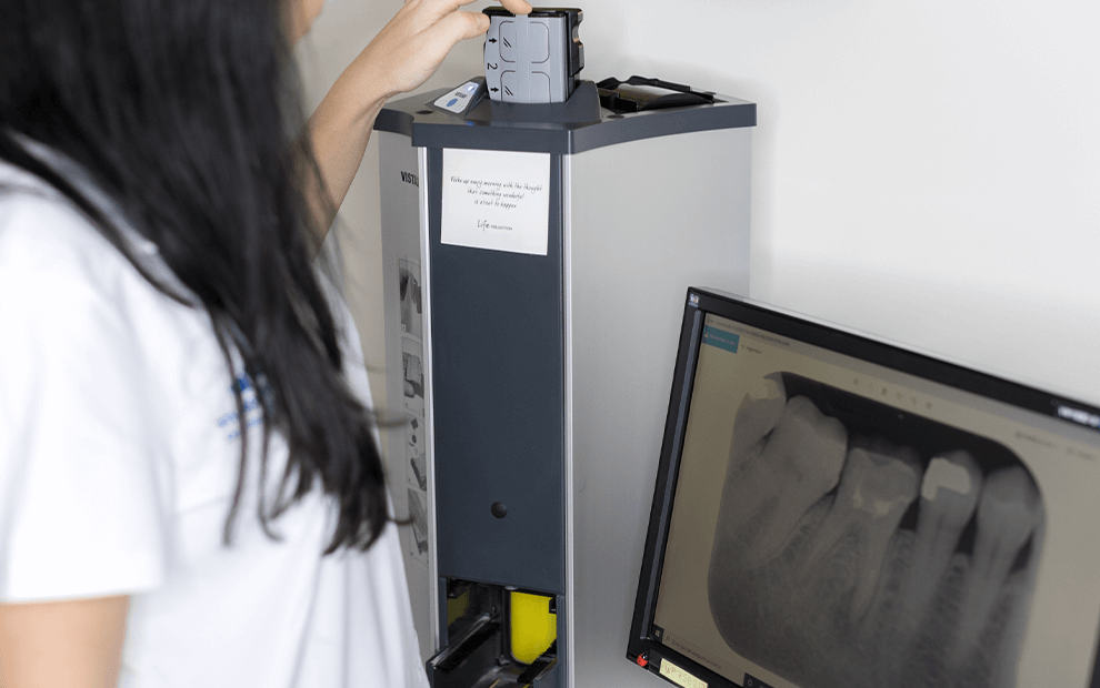 Radiografia digitale ai fosfori