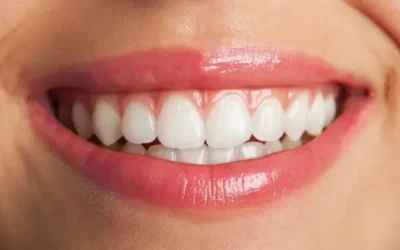 Buone abitudini per un sorriso più bianco